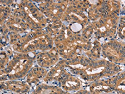TRAFD1 Antibody