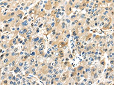 TRAIP Antibody