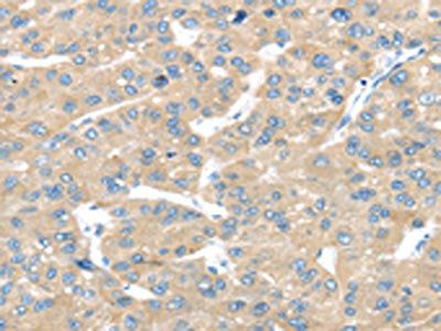 TRAK1 Antibody