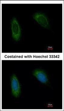 TRAM1 antibody [C2C3], C-term