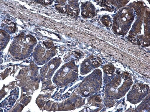 TRAM1 antibody [C2C3], C-term