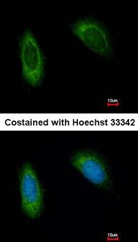translocation associated membrane protein 1 antibody