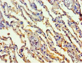 TALDO1 Antibody
