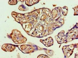 Transaldolase antibody