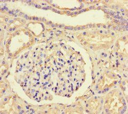 GTF2B Antibody