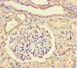 Transcription initiation factor IIB antibody