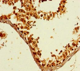 GTF2B Antibody