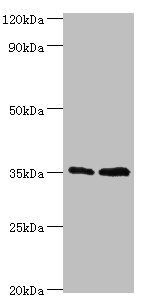 GTF2B Antibody