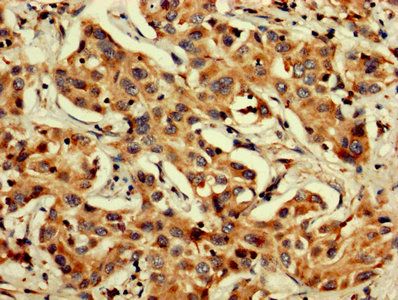TGFB1 Antibody