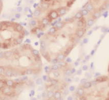 Transgelin-2-specific antibody