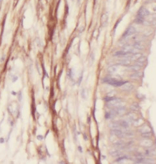 transgelin-specific antibody