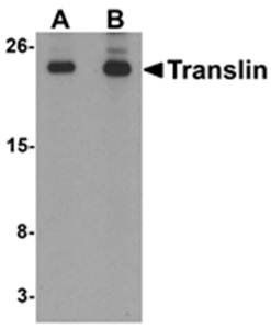 Translin Rabbit Polyclonal Antibody