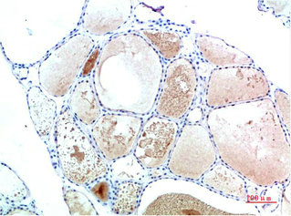 TTR Antibody