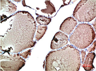 TTR Antibody