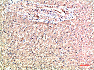 TTR Antibody