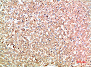 TTR Antibody