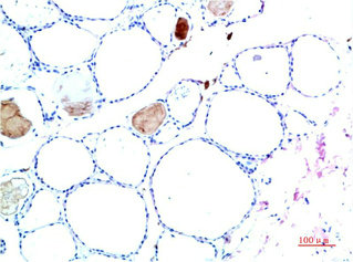 TTR Antibody