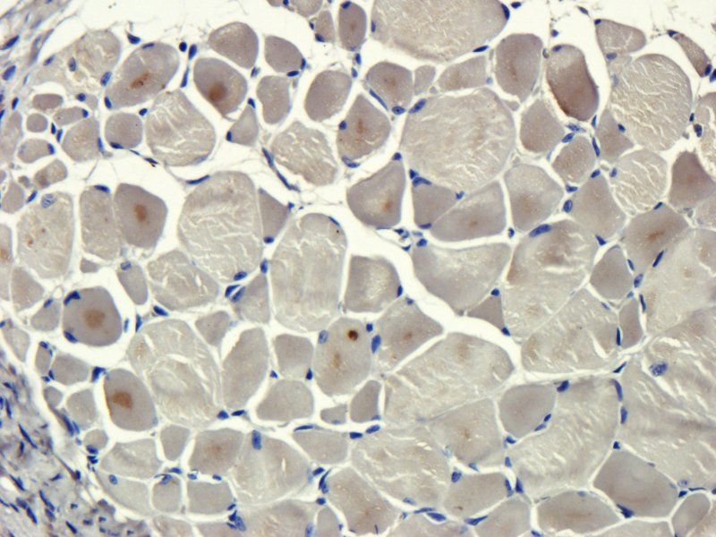 Transthyretin antibody