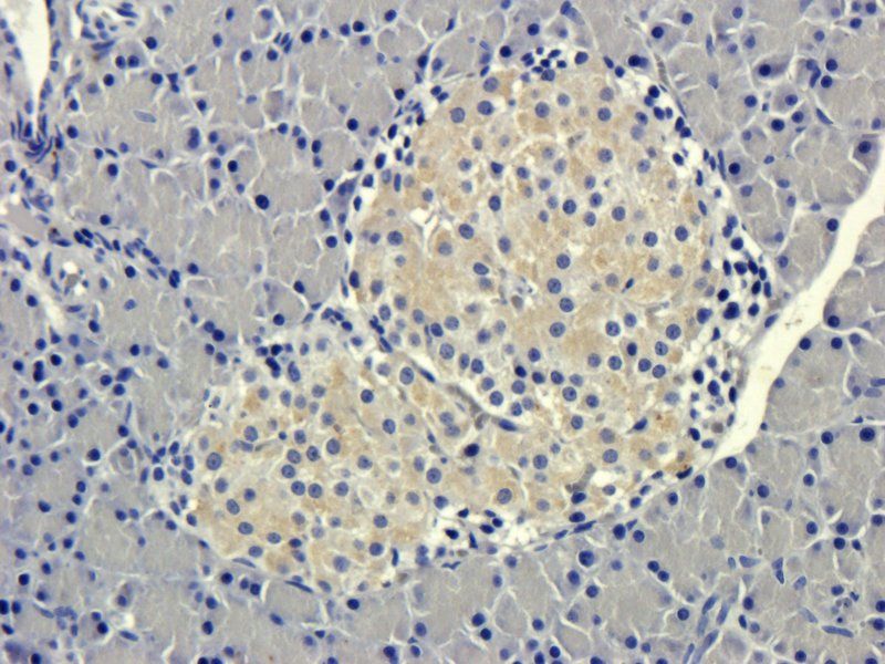 Transthyretin antibody