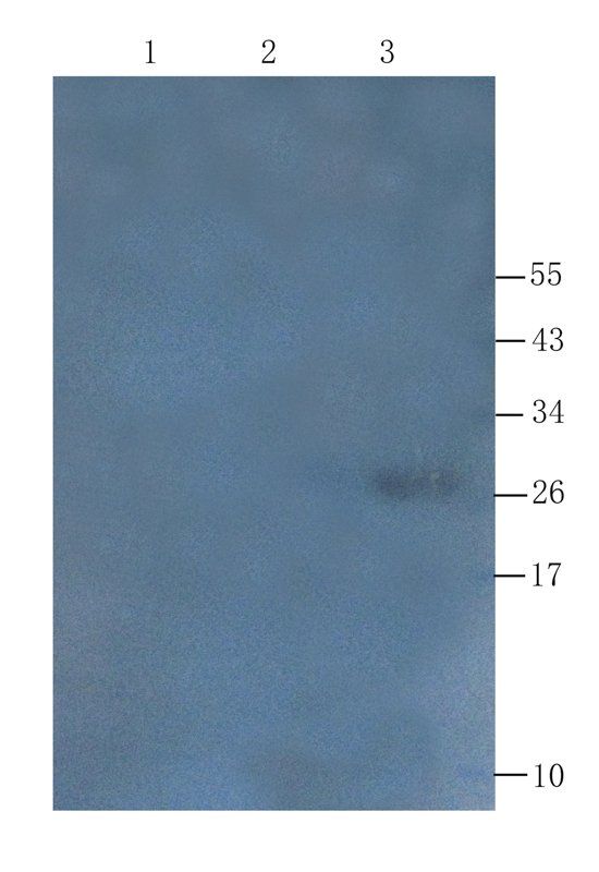 Transthyretin antibody