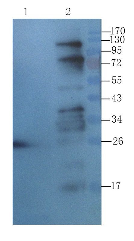 Transthyretin antibody