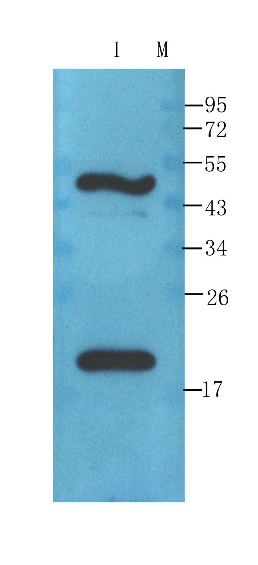 Transthyretin antibody