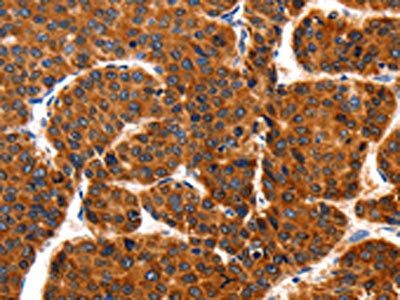 TRAP1 Antibody