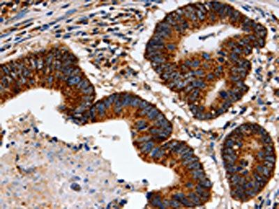 TRAP1 Antibody