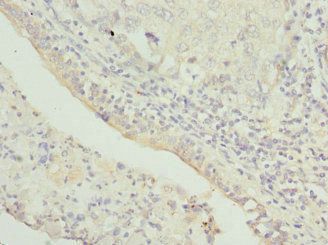 TRAPPC10 antibody