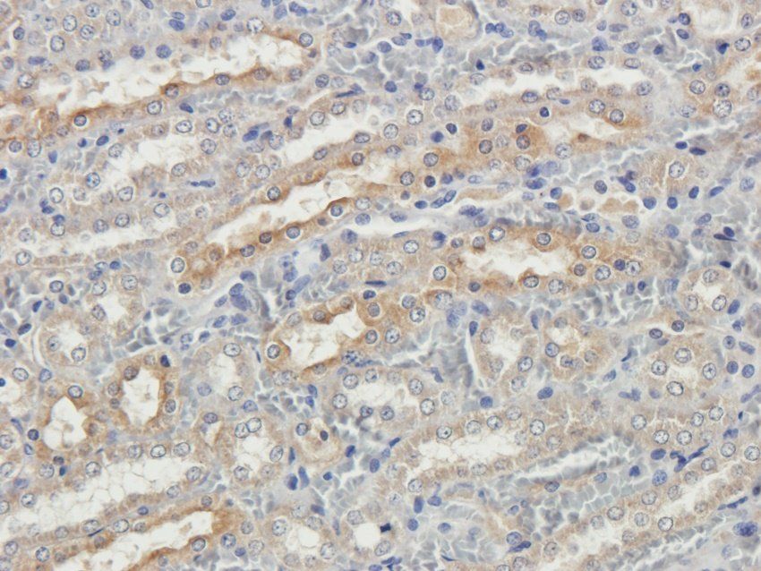 TRAPPC11 antibody