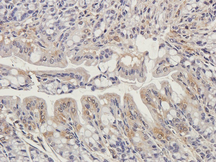 TRAPPC11 antibody