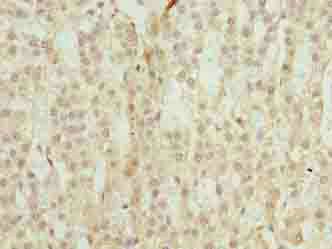 TRAPPC6B antibody