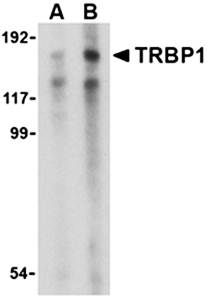 TRBP1 Rabbit Polyclonal Antibody