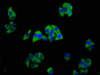 TREM2 antibody