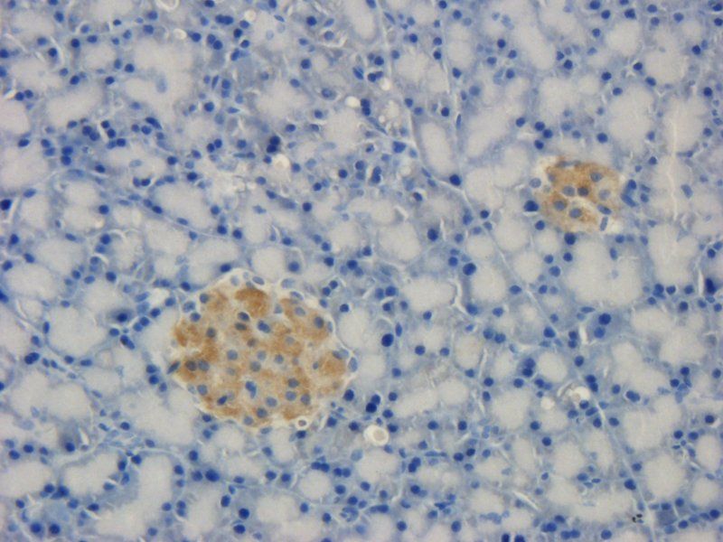 TREM2 antibody