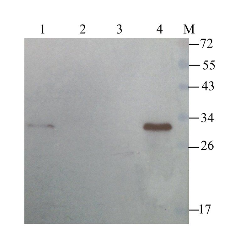 TREM2 antibody