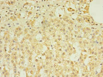 TREML2 antibody