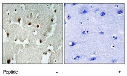 TRERF1 Antibody