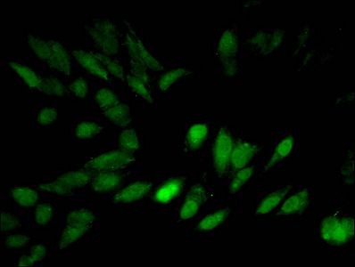 Tri-methyl-HIST1H3A (K27) Antibody