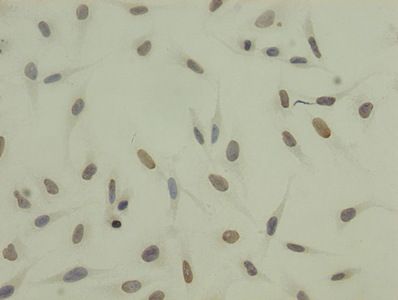 Tri-methyl-HIST1H3A (K27) Antibody