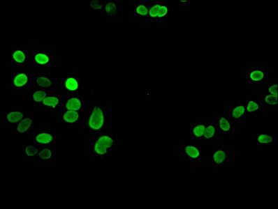 Tri-methyl-HIST1H3A (K27) antibody