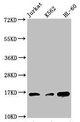 Tri-methyl-HIST1H3A (K27) antibody