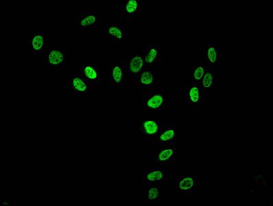 Tri-methyl-HIST1H3A (K36) antibody