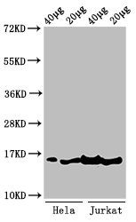 Tri-methyl-HIST1H3A (K36) antibody