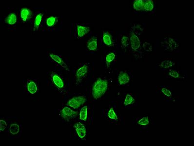 Tri-methyl-HIST1H3A (K36) Antibody