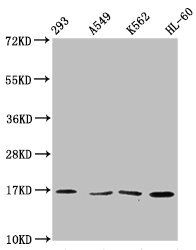 Tri-methyl-HIST1H3A (K36) antibody