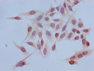 Tri-methyl-HIST1H3A (K4) Antibody