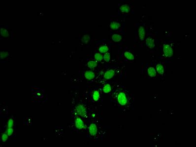 Tri-methyl-HIST1H3A (K4) antibody