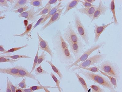 Tri-methyl-HIST1H3A (K4) Antibody