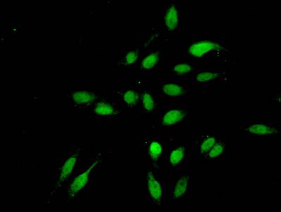 Tri-methyl-HIST1H3A (K4) antibody